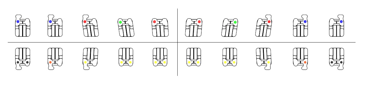 CePassTM Pro SL Brackets, einzeln