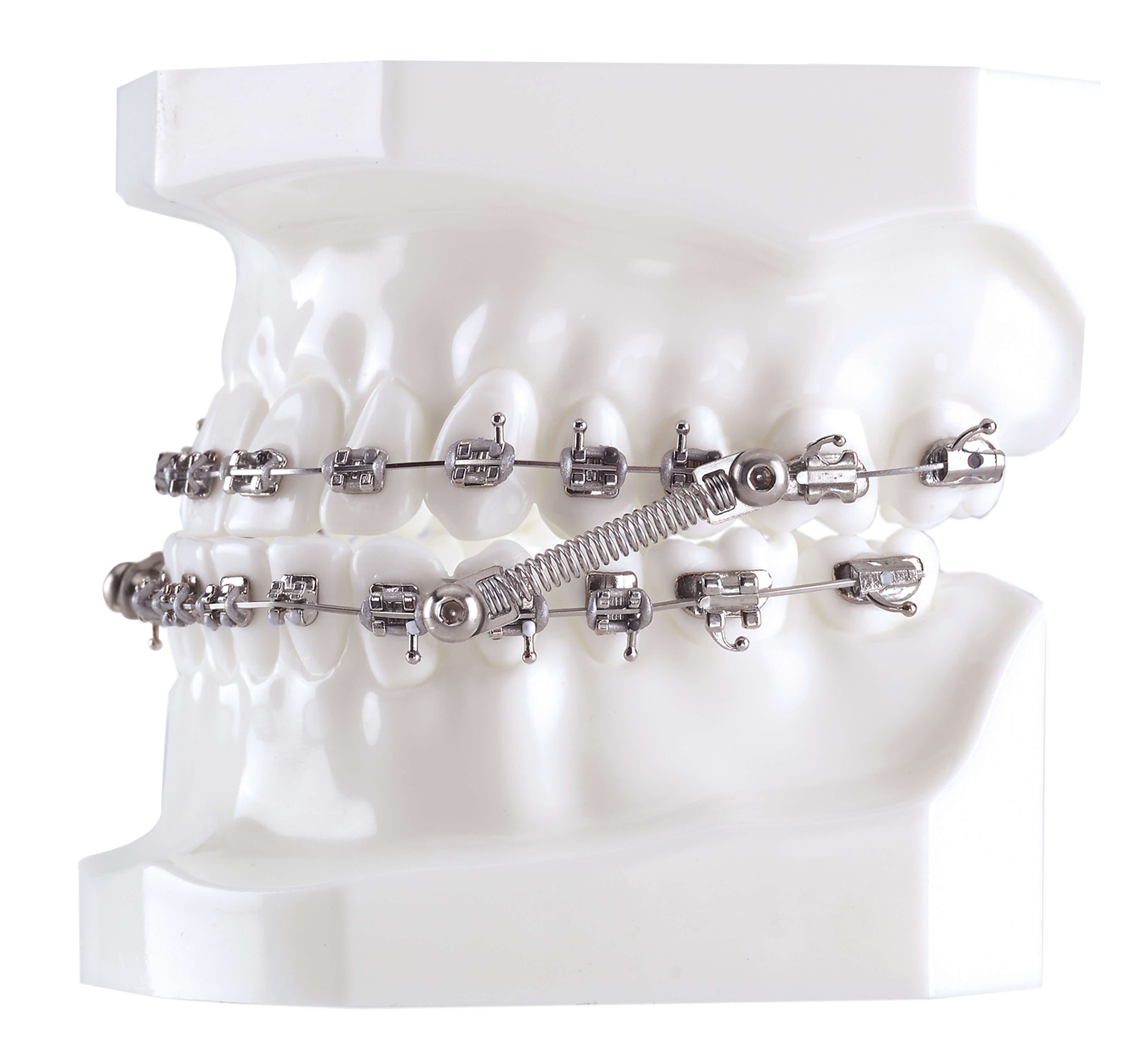 CS5 Twist Lock, 5-Patienten Kit (7 mm)