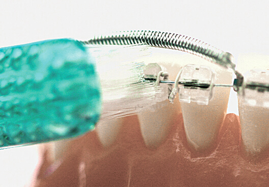 Huckepackfeder Einzelbox B1, orange