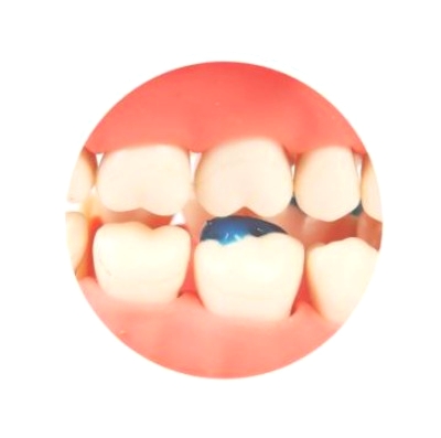 Band Zement "BLUE" Set