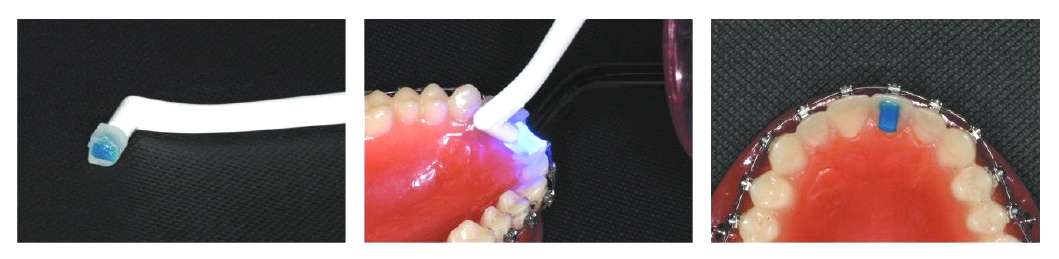 Band Zement "BLUE" Set