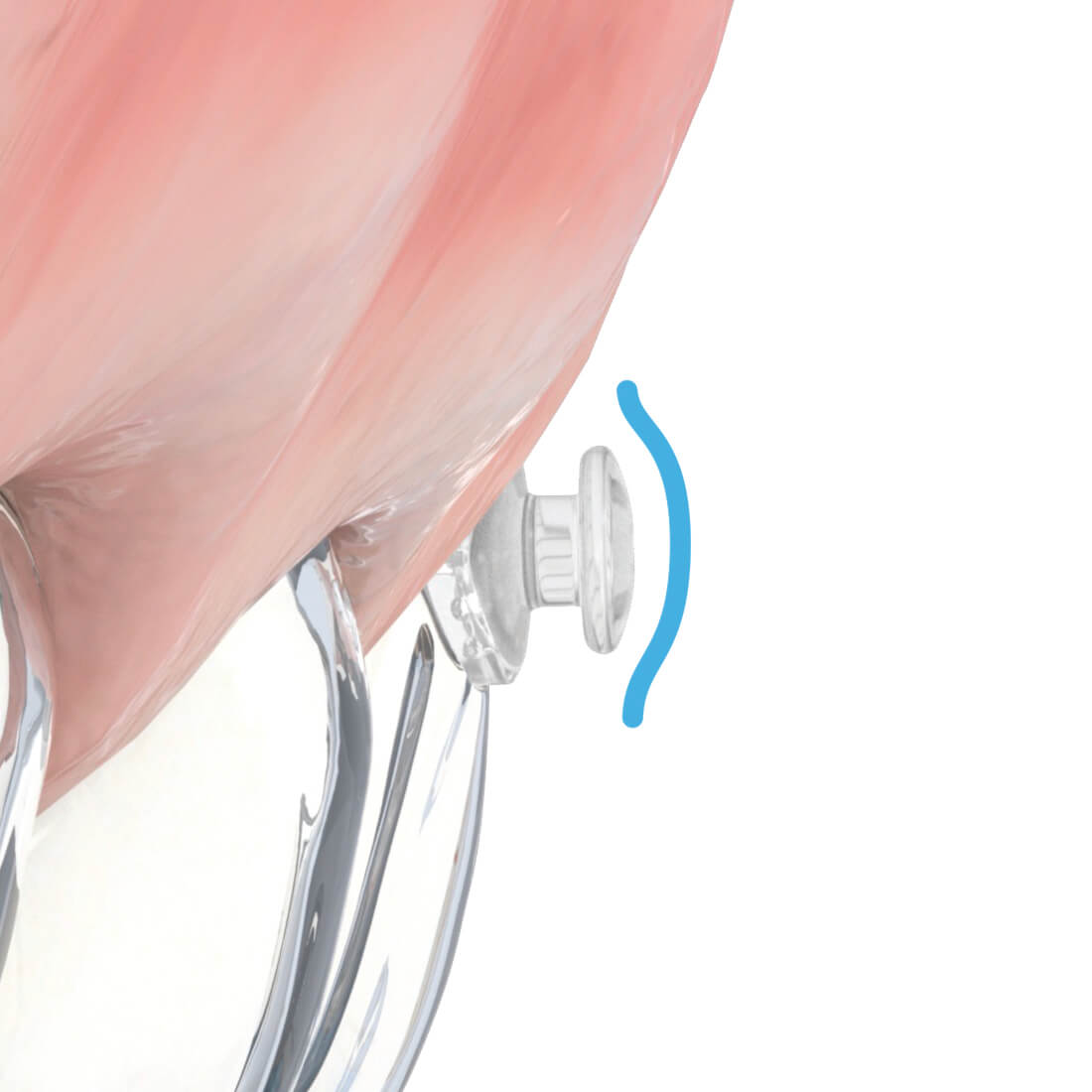 Aligner Buttons, transparent